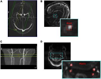 Measuring Arterial Pulsatility With Dynamic Inflow Magnitude Contrast